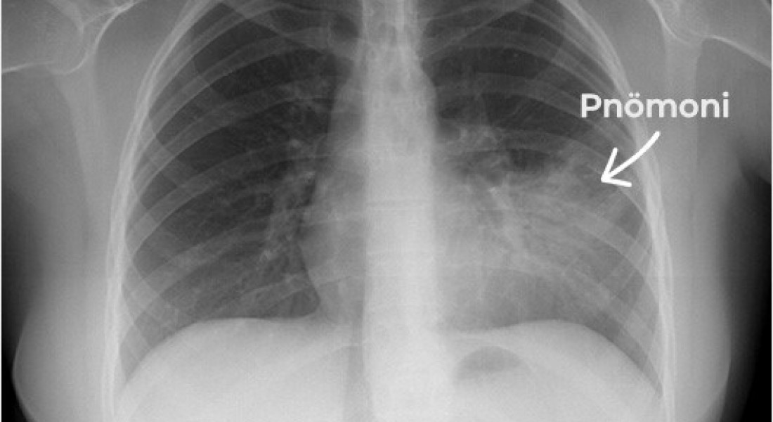 Information on Infectious Diseases: A General Guide for the Public