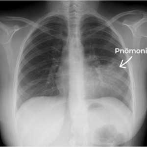 Информационное руководство для населения по инфекционным заболеваниям