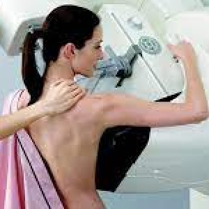 WHAT ARE MAMMOGRAPHY AND BREAST ULTRASOUND? WHO SHOULD HAVE A MAMMOGRAM AND WHEN?