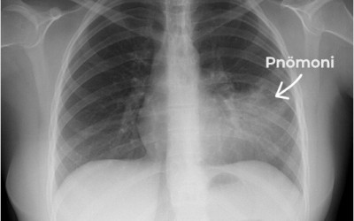 Information on Infectious Diseases: A General Guide for the Public