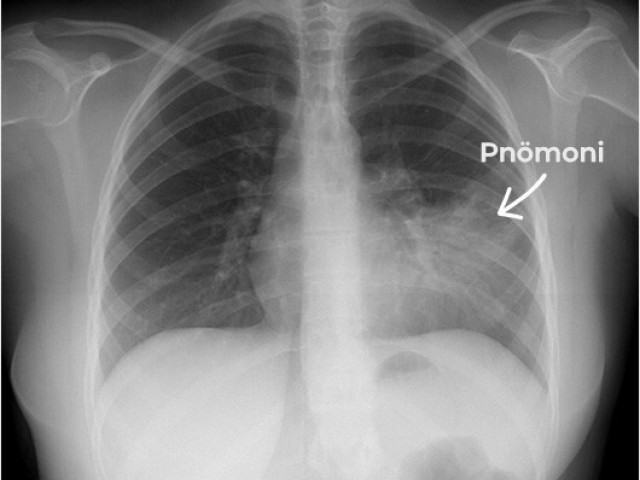 Информационное руководство для населения по инфекционным заболеваниям